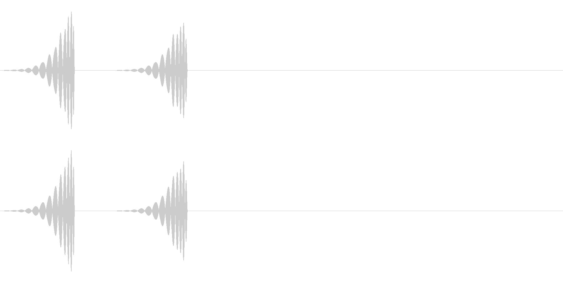 心臓の音の未再生の波形